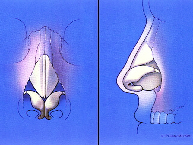 Illustrations, Gunter (Nose) (19970128163440609) 19970429082958734